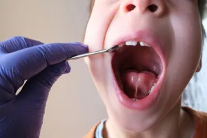 Young child with a tongue tie